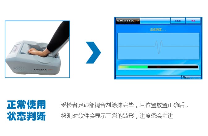 骨密度儀正常判斷_骨密度測(cè)定