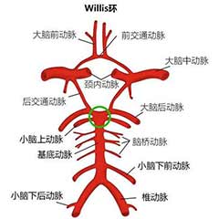 經(jīng)顱多普勒（TCD）可檢測(cè)的顱內(nèi)動(dòng)脈大盤點(diǎn)！