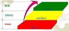 超聲骨密度儀廠(chǎng)家介紹：兩次骨密度檢查結(jié)果如何對(duì)比