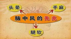 腦中風的前兆早知道 經顱多普勒幫助檢查腦血管疾病